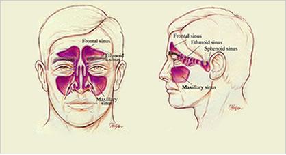 anatomy of sinus infection